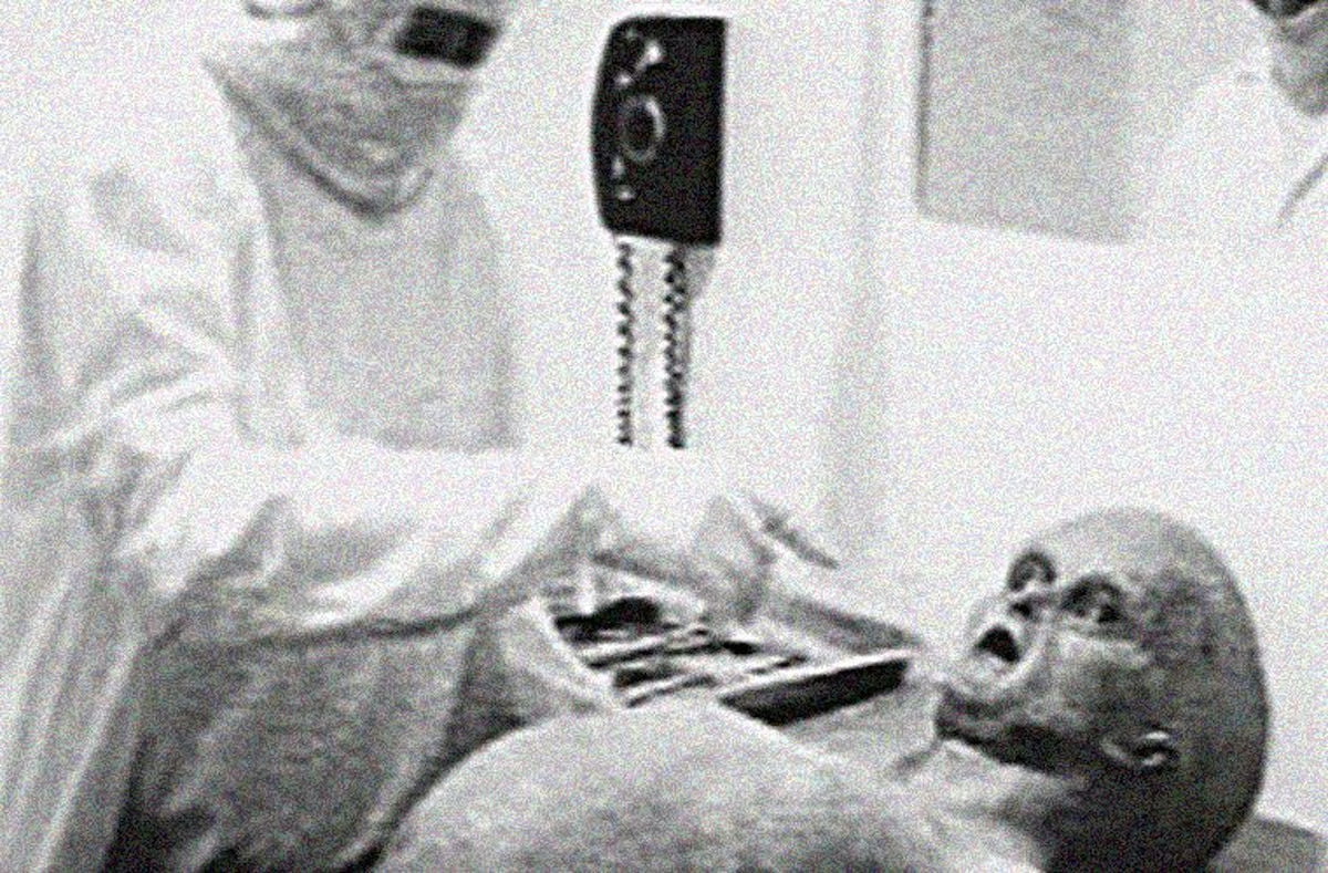 Reprodução do vídeo Alien Autopsy, de Ray Santilli (Reprodução/Youtube)